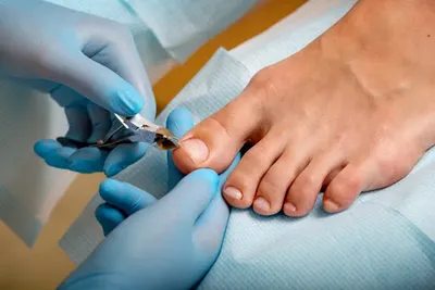 Zdrowe Stopy Emilia Bała - Podolog Bydgoszcz